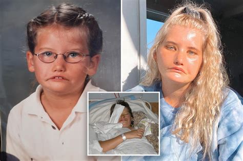 The rare medical condition that means this woman has 11。